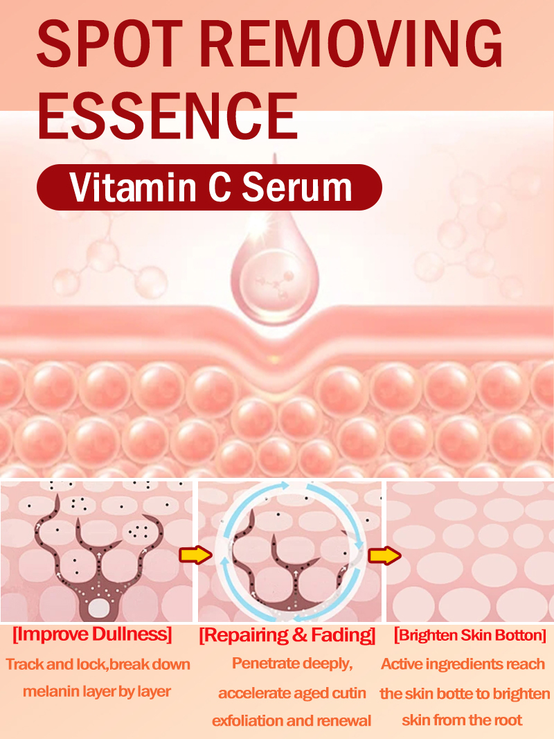 Verlicht sproeten Melasma, don - Ultra Luxury Skincare recensie en prijs